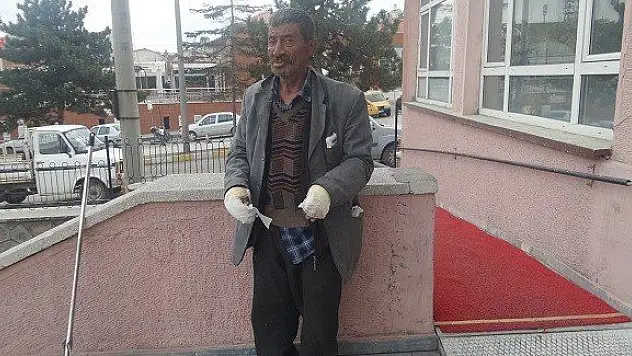 Su yerine benzin döktü, ölümden döndü