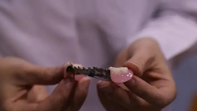 5 kişinin öldürüldüğü cinayeti protez ve implant diş parçaları çözdü