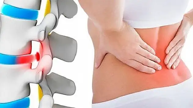 Bel fıtığı ameliyatsız yöntemlerle tedavi edilebiliyor