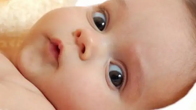 Bebeklerde bu belirtilere dikkat!