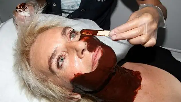 Yorgun Cilde 'Çikolata' İle Hayat Öpücüğü