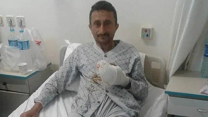 Patoza elini kaptırdı, parmakları koptu