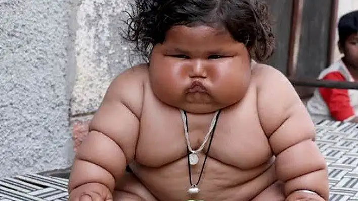 Hindistan'da 8 aylık bebek 17 kilo ağırlında