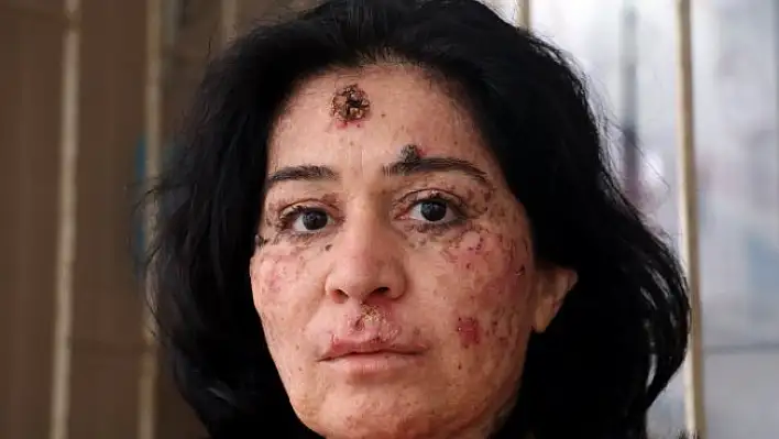 Bilim dünyasına haykırış! 'Deneylere katılmak istiyorum'