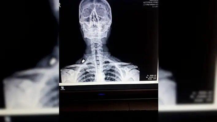 Ensesine nereden geldiği belli olmayan kurşun saplandı