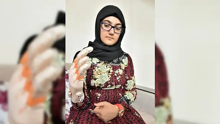 Lise öğrencileri 15 yaşındaki kıza protez el geliştirdi