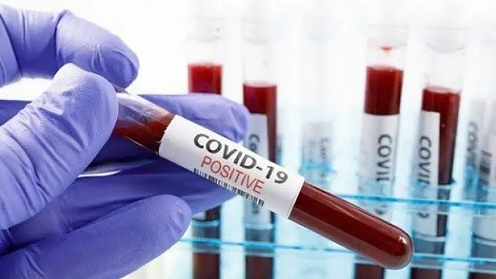 Testi pozitif çıkan hastanın otobüsle evine gönderildiği iddiası!